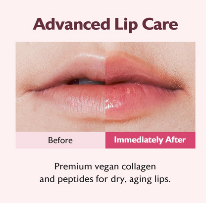 Milktouch Vegan Glow Up Collagen Lip Balm–Hydrating Lip Care with Collagen for Dry Lips Repair(15g) 03. Berry Tart